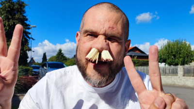 Житель Швеции засунул в ноздри 81 спичку ради детей