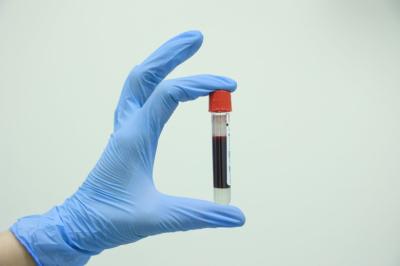 В России могут зарегистрировать препарат для лечения рака крови