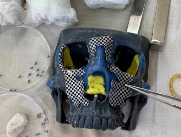 В Челнах врачи восстановили девушке лицо из осколков после тяжелейших травм