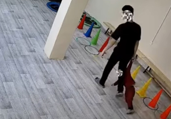 Гипс после ЛФК